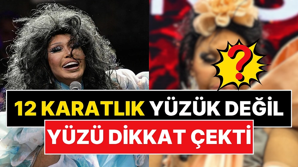 Lolita Estetiğiyle Yüzünü Gerdirmişti: Bülent Ersoy'un Son Hali Ortaya Çıktı!