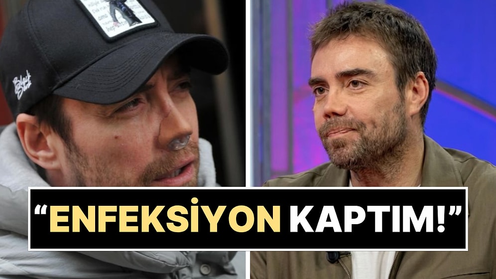 “Burnum Yoktu” Diyen Murat Dalkılıç, Burnunu Kaybetme Noktasına Nasıl Geldiğini İlk Kez Anlattı