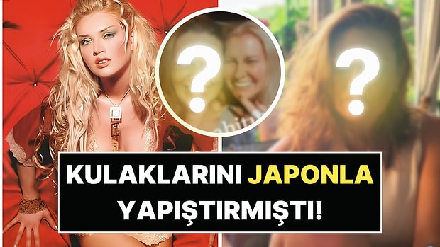 Kulaklarını Japon Yapıştırıcısıyla Yapıştırıp Hastanelik Olan Model Doğa Bekleriz'in Son Hali Ortaya Çıktı!