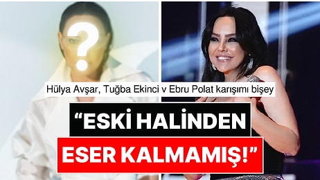 Yüzüne 10 Milyon TL Harcamıştı: Ebru Gündeş'in Son Halini Görenler Tanımakta Zorlandı!