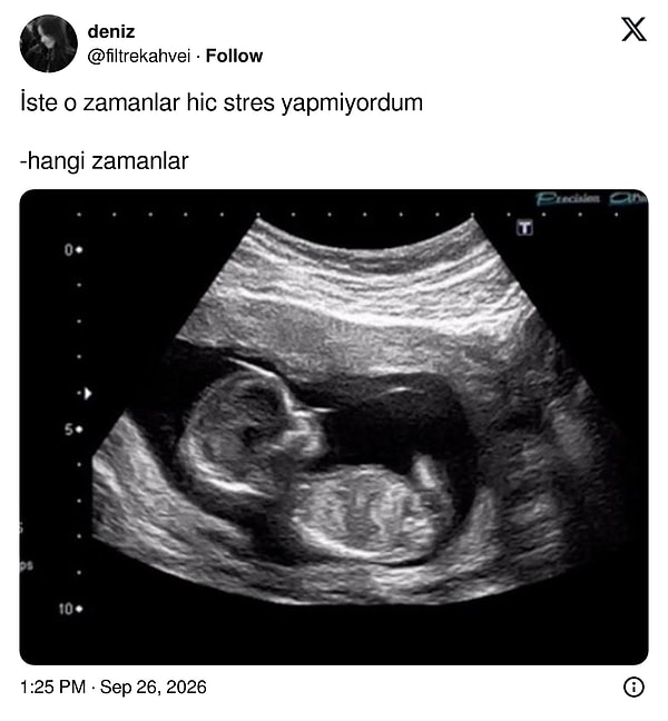 Stressiz günlerin tek kanıtı bir ultrason fotoğrafı