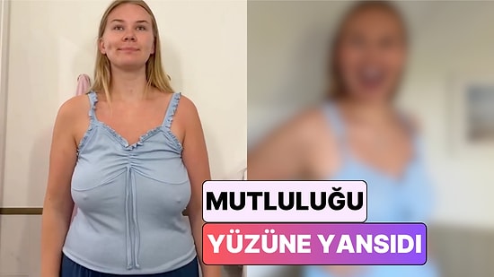 Bir İçerik Üreticisi Meme Küçültme Ameliyatının Hayatında Yarattığı Değişimi Paylaştı