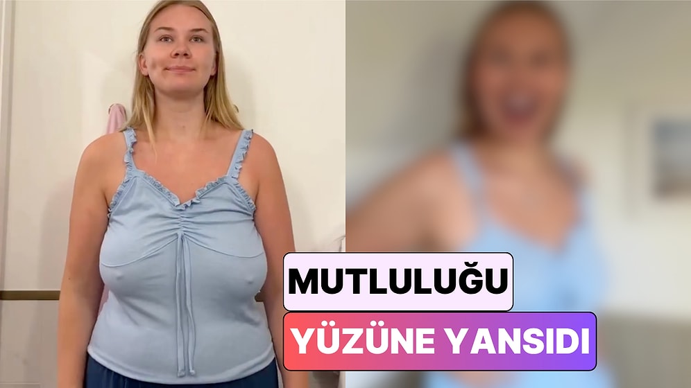 Bir İçerik Üreticisi Meme Küçültme Ameliyatının Hayatında Yarattığı Değişimi Paylaştı