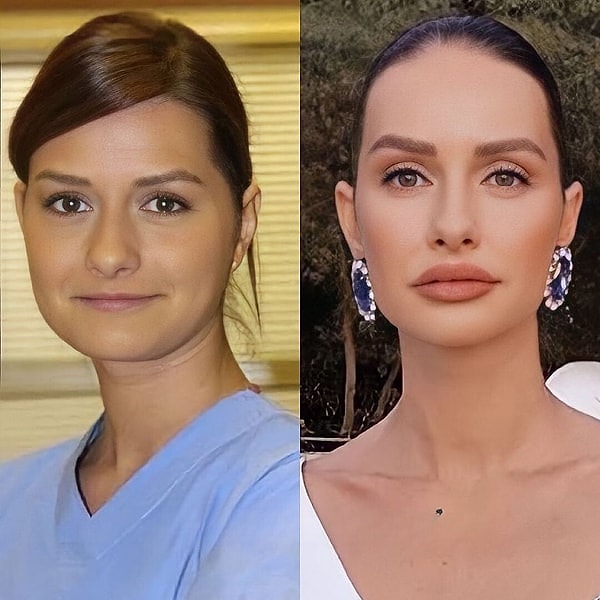 Boşanmasının ardından yıllar sonra ekranlara dönen Yasemin Ergene, Tuzlu Kahve'yle beraber resmen Doktorlar nostaljisi yaşatmaya başladı!