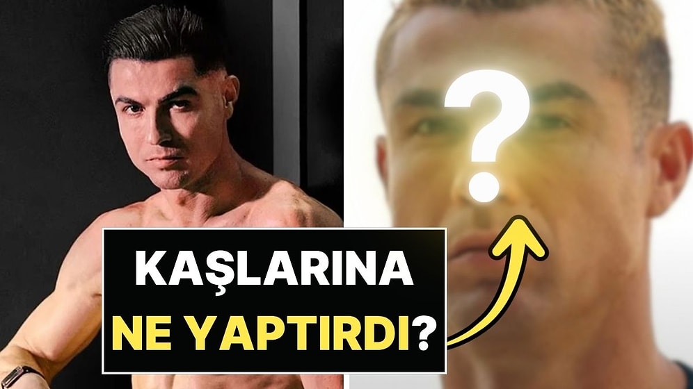 Cristiano Ronaldo'nun Kaşlarının Son Hali Olay Oldu: Yaptırdığı İşlem Estetik Tartışması Başlattı!