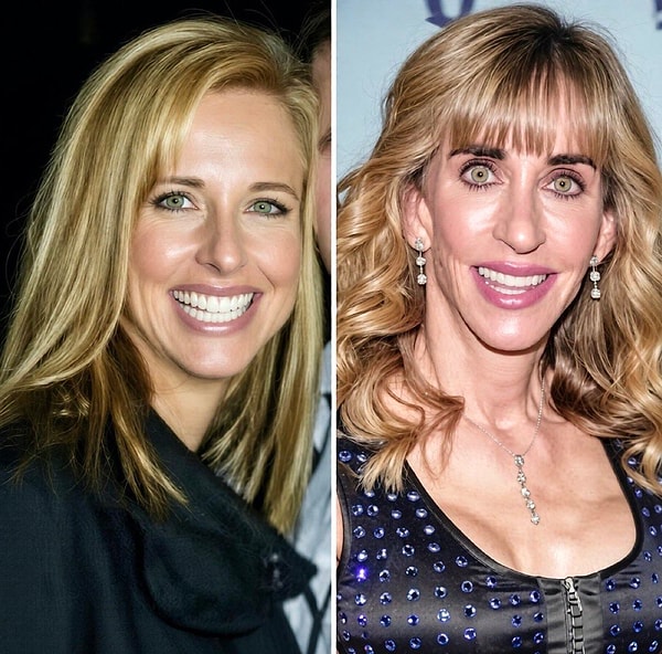Asıl şaşkınlık ise Susan Dell'in eski fotoğrafları ortaya çıkınca yaşandı! Yıllar içerisindeki değişimini gören sosyal medya kullanıcıları, iki görüntü arasındaki farklılıkları konuşmaya başladı.