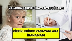 Yıllarca Gözlerindeki Kaşıntının Nedenini Aradı: Kirpiklerinden Çıkanlara İnanamadı
