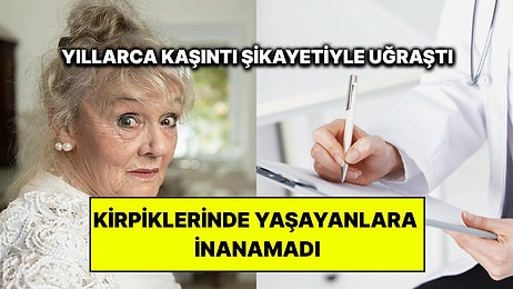 Yıllarca Gözlerindeki Kaşıntının Nedenini Aradı: Kirpiklerinden Çıkanlara İnanamadı