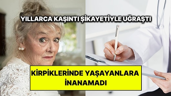 Yıllarca Gözlerindeki Kaşıntının Nedenini Aradı: Kirpiklerinden Çıkanlara İnanamadı