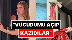 Danla Bilic Dokuzuncu Ameliyatın Perde Arkasını Anlattı: "Bu Son Kurşunumuzdu!"
