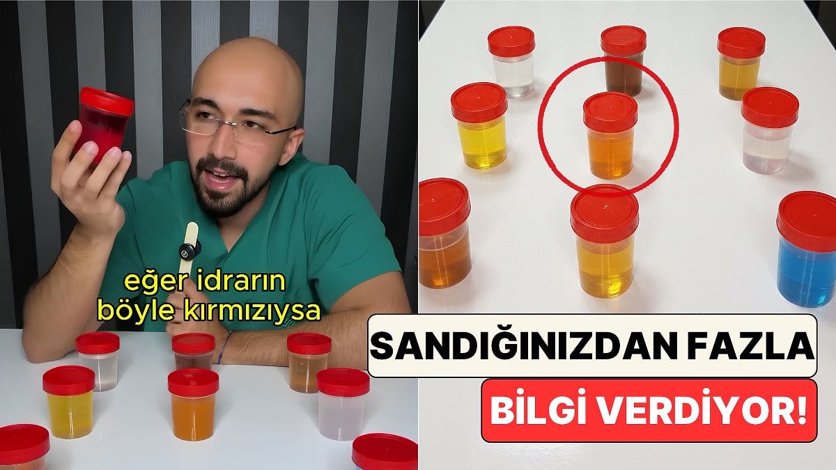 Doktor Yunus Ensari İdrar Renginin Sağlık Hakkında Neler Söylediğini Renkli Numune Kaplarıyla Gösterdi