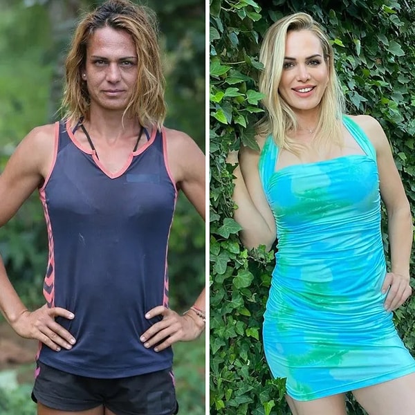 Survivor parkurlarındaki hırsı ve bitmek bilmeyen enerjisiyle tanıdığımız Nagihan Karadere, son zamanlarda yarışmadaki başarılarından çok geçirdiği estetik işlemlerle konuşuluyor!