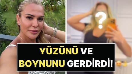 Yüzünü ve Boynunu Gerdirdi: Nagihan Karadere'nin Estetik Sonrası Görüntüsü Şaşırttı!