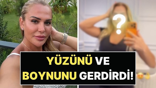 Yüzünü ve Boynunu Gerdirdi: Nagihan Karadere'nin Estetik Sonrası Görüntüsü Şaşırttı!
